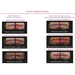 Novexpert Laboratoires - Lip Up - Balsamo Labbra Rigenerante Volumizzante Istantaneo