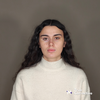 True Corrective: Vanessa TC04 • Corso di Make Up Online su Vitiligine e Pelle Iper Secca