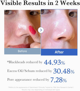 Medicube - Zero Pore Pad - Dischetti esfolianti viso con AHA e BHA per pori dilatati, punti neri e pelle irregolare