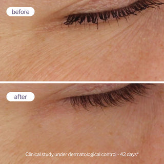 Novexpert Laboratoires - Double Pro Retinol Serum Booster AHA + PHA - Siero Booster Retinolo ritexturizzante anti age