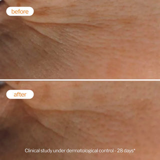 Novexpert Laboratoires - Vitamin C Radiance Night Serum - Trattamento notte Peeling Anti Age Ritexturizzante illuminante
