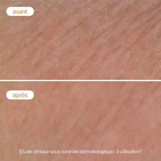 Novexpert Laboratoires - Flash Eclat - Mousse detergente illuminante esfoliante